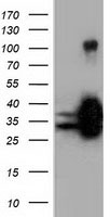 QPRT Antibody