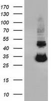 UCK Antibody