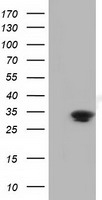 UCK1 Antibody