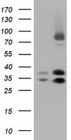 QPRT Antibody