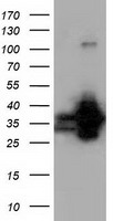 QPRT Antibody