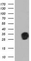 QPRT Antibody
