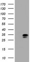QPRT Antibody