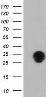 QPRT Antibody