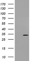 UCK Antibody