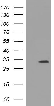 UCK Antibody