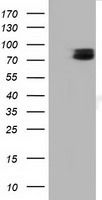 TCTN2 Antibody