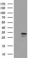 UCK Antibody
