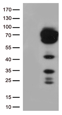 CD5 Antibody