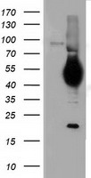 CD5 Antibody