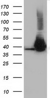 HIBCH Antibody