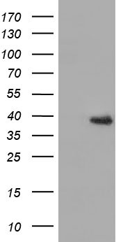 HIBCH Antibody