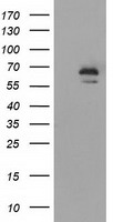 IGF2BP2 Antibody