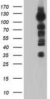 TACC3 Antibody