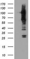 TACC3 Antibody