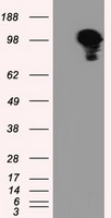 TACC3 Antibody