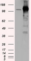 TACC3 Antibody