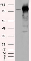TACC3 Antibody