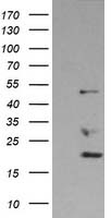 DDX39B Antibody