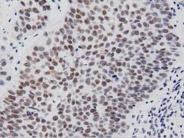 PTPRE Antibody