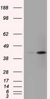 ACAT2 Antibody