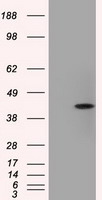 ACAT2 Antibody