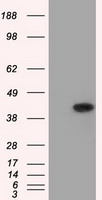 ACAT2 Antibody