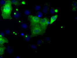 DAP Kinase 2 Antibody