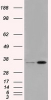 PIM2 Antibody