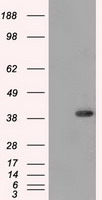 DNTTIP1 Antibody