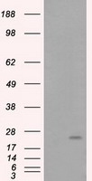 RhoGDI Antibody