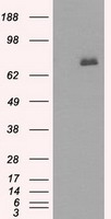 BTK Antibody