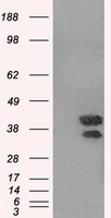 DAP Kinase 2 Antibody