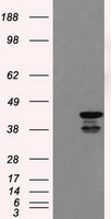 DAP Kinase 2 Antibody