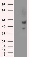 Natriuretic Peptide Receptor C Antibody