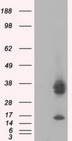 PIM2 Antibody