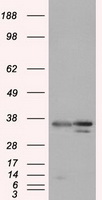 PIM2 Antibody