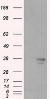 PIM2 Antibody
