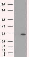 RDH11 Antibody