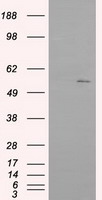 IFIT1 Antibody