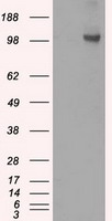 Hexokinase II Antibody