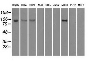 HK2 Antibody