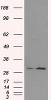 TIPRL Antibody