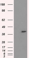 PPME1 Antibody