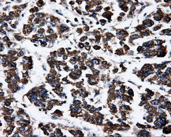 ATP5F1B Antibody