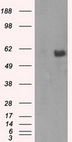 AKT2 Antibody