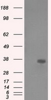 AKR1A1 Antibody