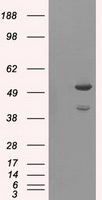 AKT2 Antibody