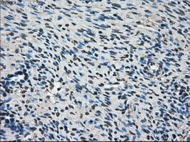 AKR1A1 Antibody