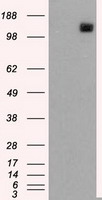 L1CAM Antibody